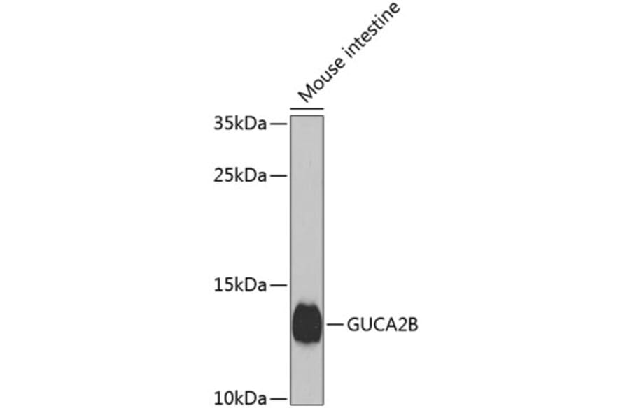 Western Blot - Anti-Uroguanylin Antibody (A17079) - Antibodies.com