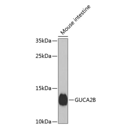 Western Blot - Anti-Uroguanylin Antibody (A17079) - Antibodies.com