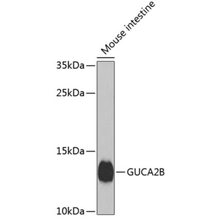 Western Blot - Anti-Uroguanylin Antibody (A17079) - Antibodies.com