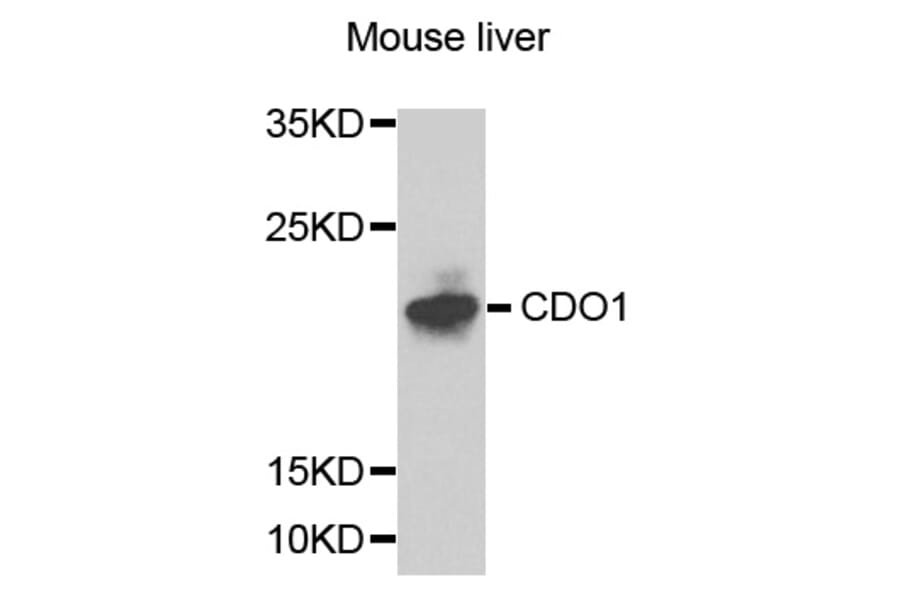 Western Blot - Anti-CDO1 Antibody (A8402) - Antibodies.com