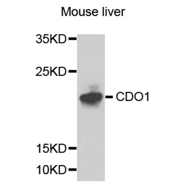 Western Blot - Anti-CDO1 Antibody (A8402) - Antibodies.com