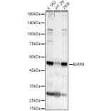 Western Blot - Anti-Estrogen Related Receptor beta Antibody (A17081) - Antibodies.com