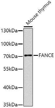 Western blot analysis of extracts of mouse thymus, using Anti-FANCE Antibody (A8417) at 1:1,000 dilution.
Secondary antibody: Goat Anti-Rabbit IgG (H+L) (HRP) (AS014) at 1:10,000 dilution.
Lysates / proteins: 25µg per lane.
Blocking buffer: 3% non-fat dry milk in TBST.
Detection: ECL Basic Kit (RM00020).
Exposure time: 10s.