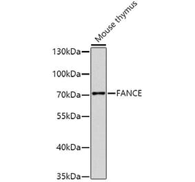 Western Blot - Anti-FANCE Antibody (A17082) - Antibodies.com