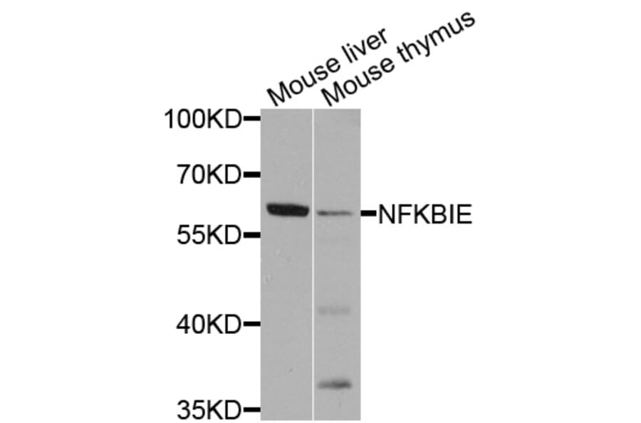 Western Blot - Anti-NFKBIE Antibody (A8443) - Antibodies.com