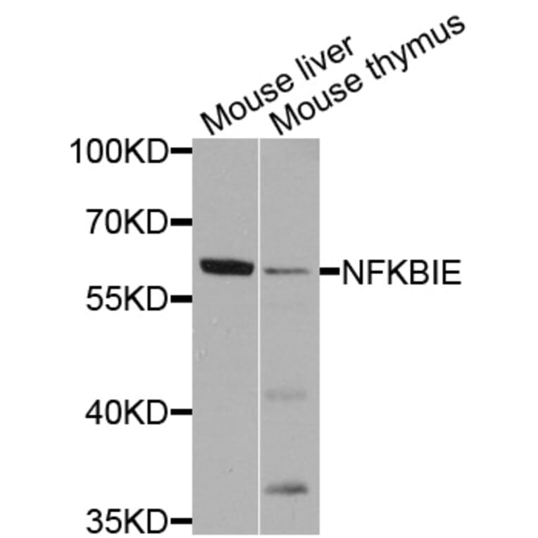 Western Blot - Anti-NFKBIE Antibody (A8443) - Antibodies.com