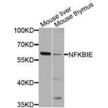 Western Blot - Anti-NFKBIE Antibody (A8443) - Antibodies.com