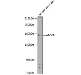 Western Blot - Anti-SUR1 Antibody (A17084) - Antibodies.com