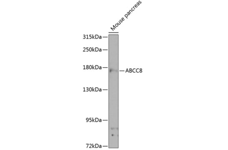 Western Blot - Anti-SUR1 Antibody (A17084) - Antibodies.com