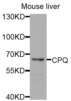 Western blot analysis of extracts of mouse liver, using Anti-CPQ Antibody (A8478) at 1:1,000 dilution.
Secondary antibody: Goat Anti-Rabbit IgG (H+L) (HRP) (AS014) at 1:10,000 dilution.
Lysates / proteins: 25µg per lane.
Blocking buffer: 3% non-fat dry milk in TBST.
Detection: ECL Basic Kit (RM00020).
Exposure time: 30s.