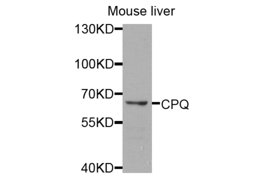 Western Blot - Anti-CPQ Antibody (A8478) - Antibodies.com