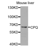 Western Blot - Anti-CPQ Antibody (A8478) - Antibodies.com