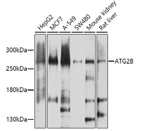 Western Blot - Anti-ATG2B Antibody (A17089) - Antibodies.com