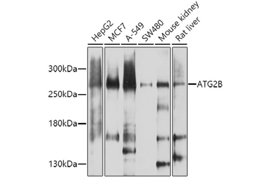 Western Blot - Anti-ATG2B Antibody (A17089) - Antibodies.com