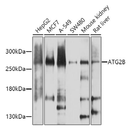 Western Blot - Anti-ATG2B Antibody (A17089) - Antibodies.com