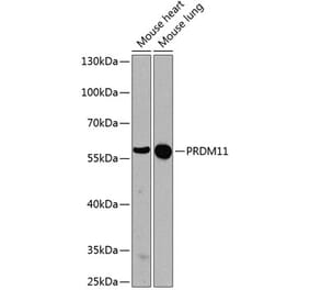 Western Blot - Anti-PRDM11 Antibody (A17090) - Antibodies.com