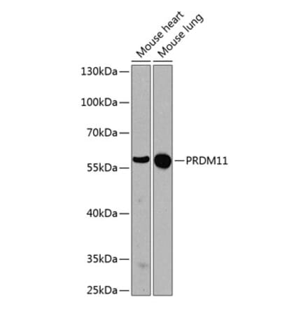 Western Blot - Anti-PRDM11 Antibody (A17090) - Antibodies.com