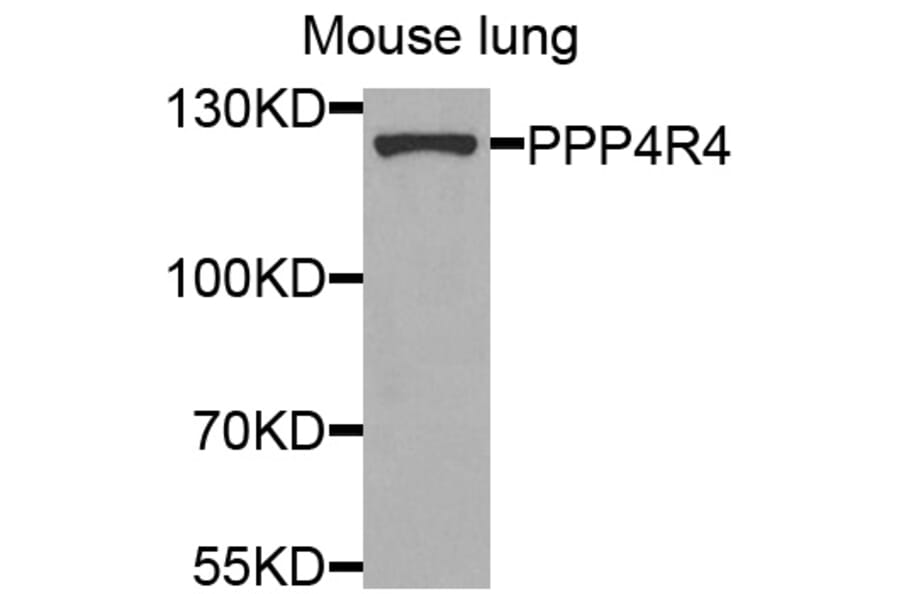 Western Blot - Anti-PPP4R4 Antibody (A8505) - Antibodies.com