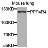 Western Blot - Anti-PPP4R4 Antibody (A8505) - Antibodies.com