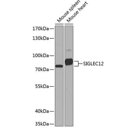 Western Blot - Anti-SIGLEC12 Antibody (A17092) - Antibodies.com