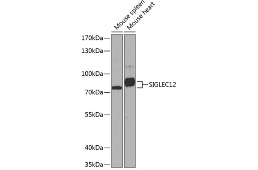 Western Blot - Anti-SIGLEC12 Antibody (A17092) - Antibodies.com