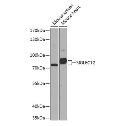 Western Blot - Anti-SIGLEC12 Antibody (A17092) - Antibodies.com