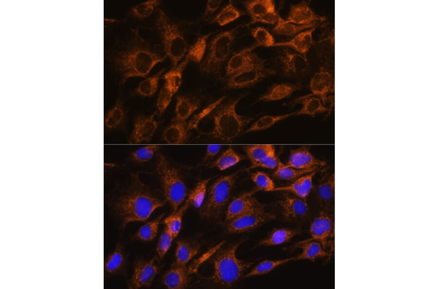Immunofluorescence - Anti-AQP8 Antibody (A17093) - Antibodies.com