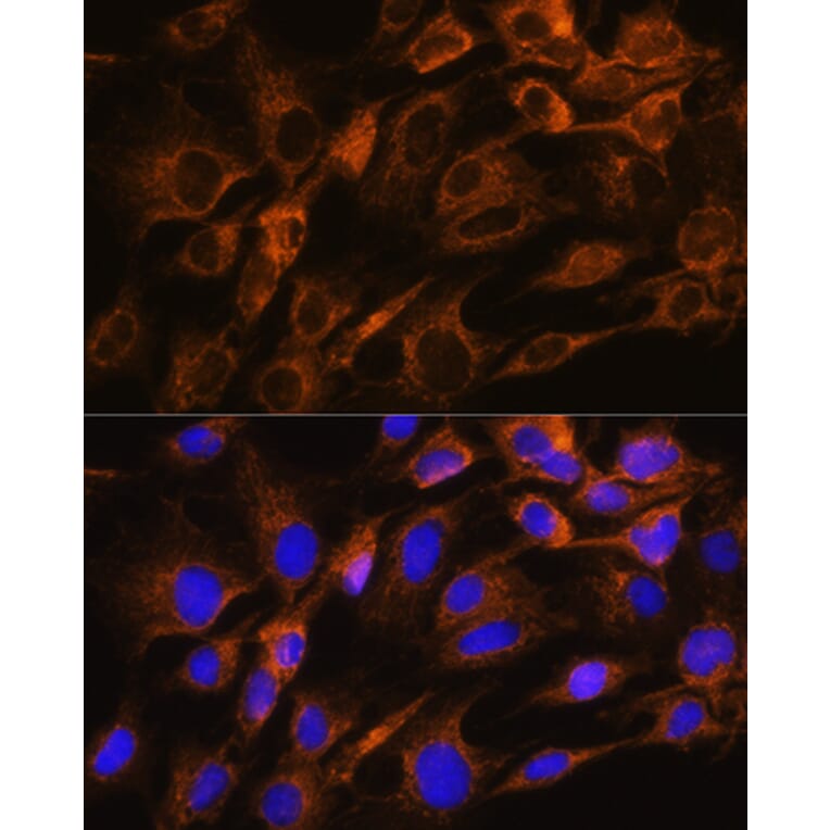 Immunofluorescence - Anti-AQP8 Antibody (A17093) - Antibodies.com