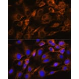 Immunofluorescence - Anti-AQP8 Antibody (A17093) - Antibodies.com
