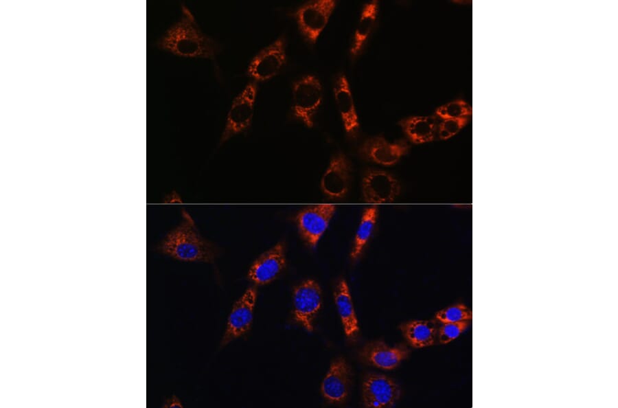 Immunofluorescence - Anti-AQP8 Antibody (A17093) - Antibodies.com
