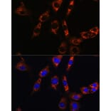 Immunofluorescence - Anti-AQP8 Antibody (A17093) - Antibodies.com