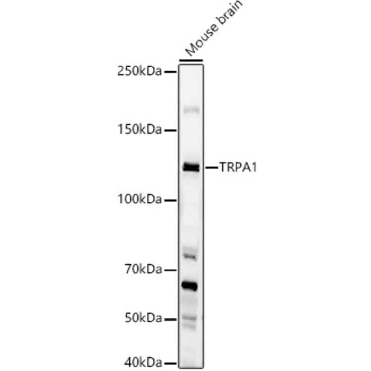 Western Blot - Anti-TRPA1/TSA Antibody (A17095) - Antibodies.com