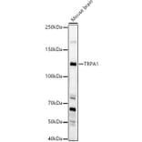 Western Blot - Anti-TRPA1/TSA Antibody (A17095) - Antibodies.com