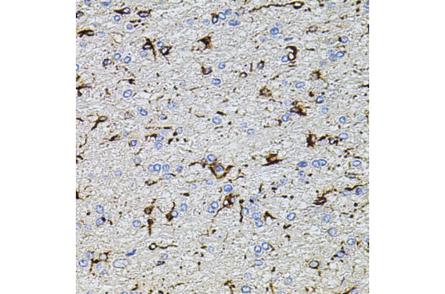 Immunohistochemistry - Anti-TRPA1/TSA Antibody (A17095) - Antibodies.com