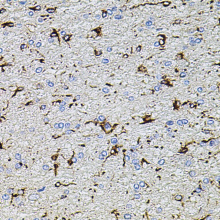 Immunohistochemistry - Anti-TRPA1/TSA Antibody (A17095) - Antibodies.com