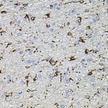Immunohistochemistry - Anti-TRPA1/TSA Antibody (A17095) - Antibodies.com