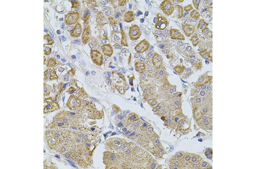 Immunohistochemistry - Anti-TRPA1/TSA Antibody (A17095) - Antibodies.com