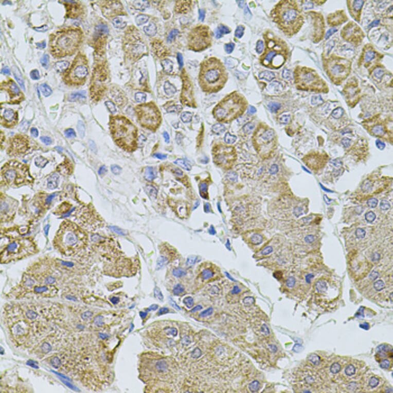 Immunohistochemistry - Anti-TRPA1/TSA Antibody (A17095) - Antibodies.com