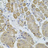 Immunohistochemistry - Anti-TRPA1/TSA Antibody (A17095) - Antibodies.com