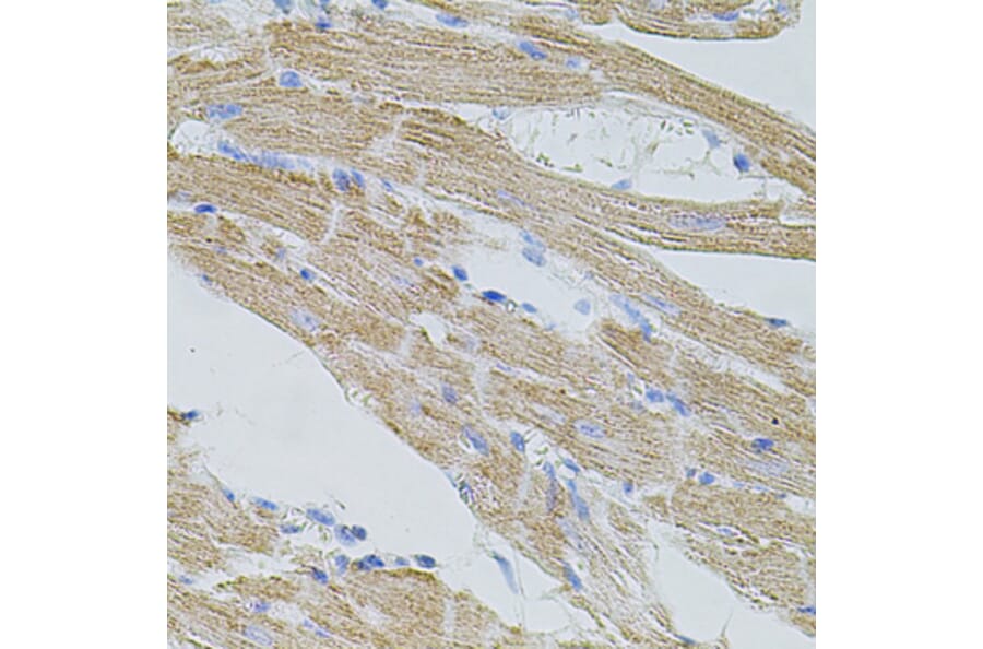 Immunohistochemistry - Anti-TRPA1/TSA Antibody (A17095) - Antibodies.com