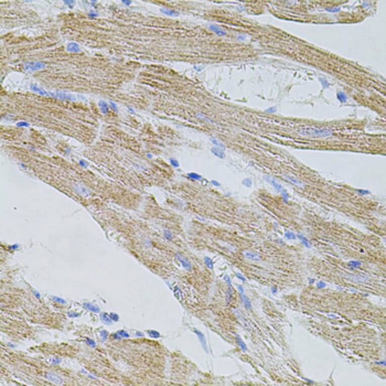 Immunohistochemistry - Anti-TRPA1/TSA Antibody (A17095) - Antibodies.com