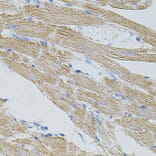 Immunohistochemistry - Anti-TRPA1/TSA Antibody (A17095) - Antibodies.com