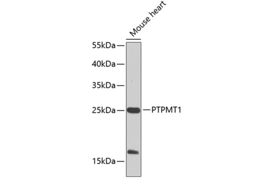 Western Blot - Anti-PTPMT1 Antibody (A17096) - Antibodies.com