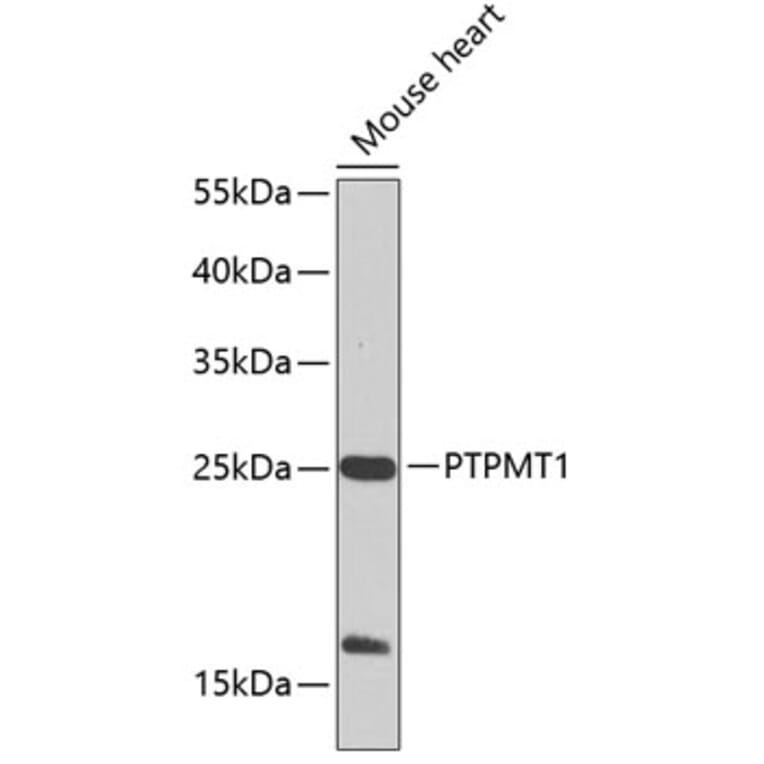 Western Blot - Anti-PTPMT1 Antibody (A17096) - Antibodies.com