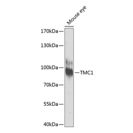 Western Blot - Anti-TMC1 Antibody (A17097) - Antibodies.com