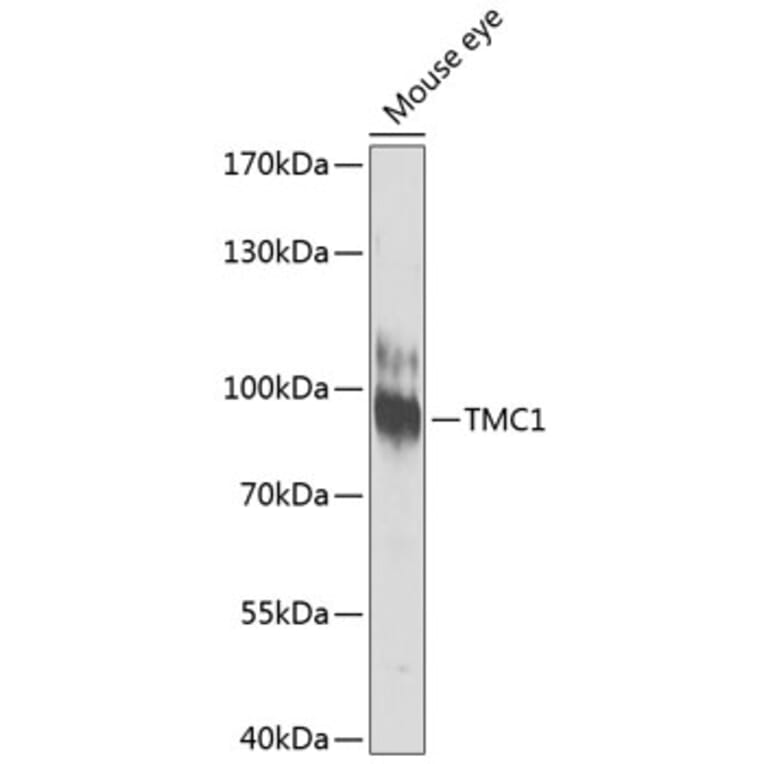 Western Blot - Anti-TMC1 Antibody (A17097) - Antibodies.com