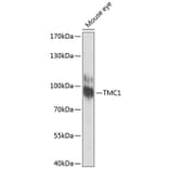 Western Blot - Anti-TMC1 Antibody (A17097) - Antibodies.com