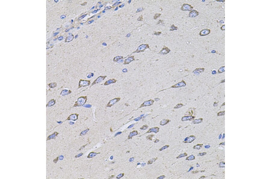 Immunohistochemistry - Anti-TMC1 Antibody (A17097) - Antibodies.com