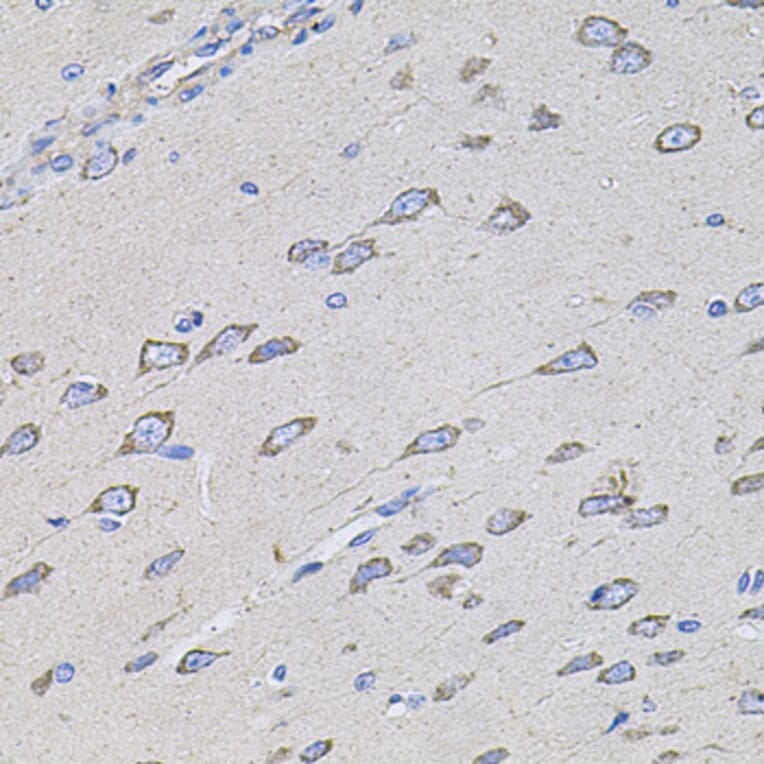 Immunohistochemistry - Anti-TMC1 Antibody (A17097) - Antibodies.com