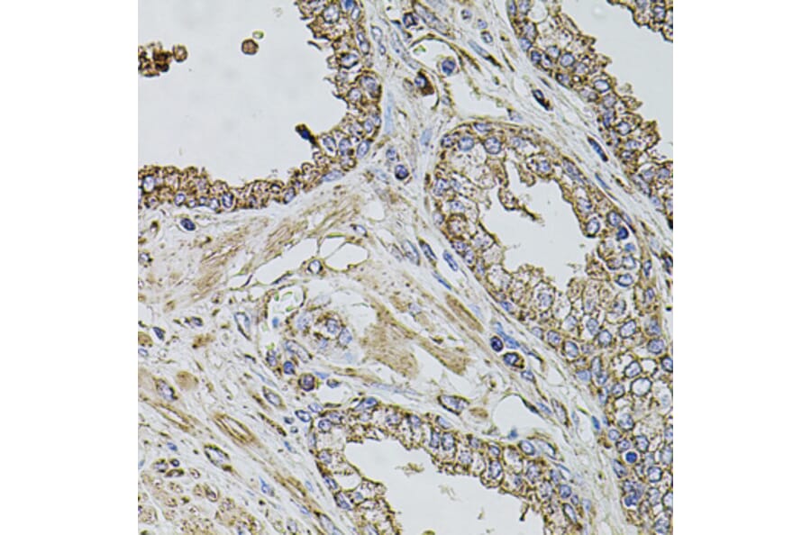Immunohistochemistry - Anti-TMC1 Antibody (A17097) - Antibodies.com
